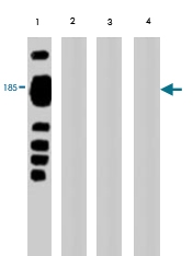 MAB1728 - Vitellogenin