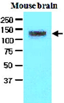 MAB1769 - EPHA2 / ECK