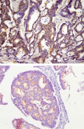 MAB1770 - ACOT11 / BFIT
