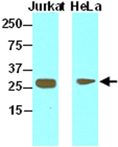 MAB1771 - HMGB1