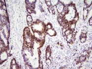 MAB1771 - HMGB1