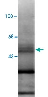 MAB1780 - RAR-beta / RARB