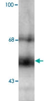 MAB1784 - THRB / ERBA2