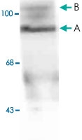 MAB1785 - Progesterone receptor