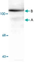 MAB1786 - Progesterone receptor