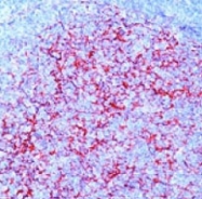 MAB1793 - CD106 / VCAM1