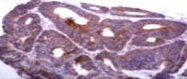 MAB1799 - TIMP1