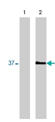 MAB1805 - MMP-9