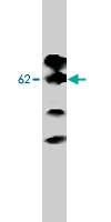 MAB1808 - Alpha-2B adrenergic receptor / ADRA2B