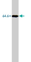 MAB1824 - ATIC / PURH