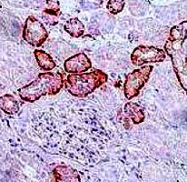 MAB1825 - VHL
