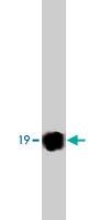 MAB1830 - Alpha-Synuclein / SNCA