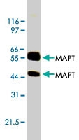 MAB1832 - MAPT / TAU