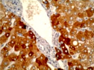 MAB1858 - CYP2A6