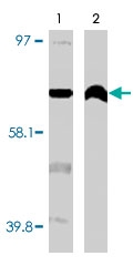 MAB1861 - CYP4F11