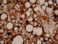 MAB1861 - CYP4F11