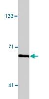 MAB1880 - Estrogen receptor alpha