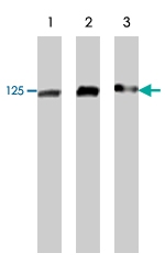 MAB1881 - FAK1 / PTK2