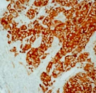 MAB1889 - HSPB1 / HSP27