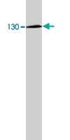 MAB1906 - Tyrosine-protein kinase JAK2
