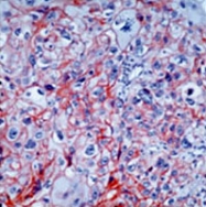 MAB1914 - EGFR / ERBB1