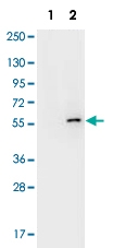 MAB1919 - AKT1 / PKB