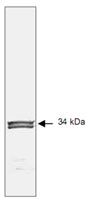 MAB1921 - CDK1