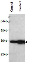 MAB1921 - CDK1