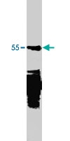 MAB1943 - LEF1
