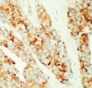 MAB1945 - Major Vault Protein