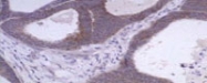 MAB1950 - MMP-1