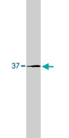 MAB1950 - MMP-1
