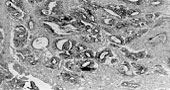 MAB1951 - MMP-3