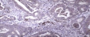 MAB1952 - MMP-9