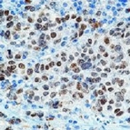 MAB1955 - MITF