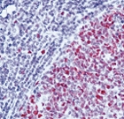 MAB1956 - MSH2