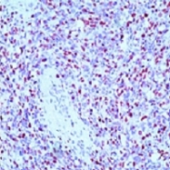 MAB1961 - Myogenin