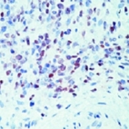 MAB1962 - MYOD1