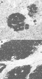 MAB1963 - Neuron specific enolase