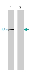 MAB1963 - Neuron specific enolase