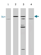 MAB1966 - NSF