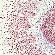 MAB1979 - XRCC6 / Ku70