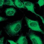 MAB1991 - pan Cytokeratin