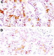 MAB1992 - Mesothelin