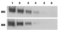 MAB1992 - Mesothelin