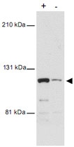 MAB1995 - MTBP