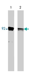 MAB2023 - STAT3