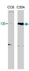 MAB2026 - RBL2 / p130
