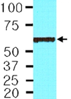 MAB2036 - Protein phosphatase 1B / PPM1B