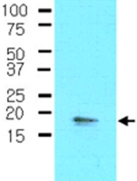MAB2039 - PPP1R14A